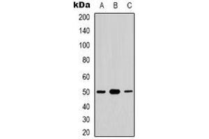 Western blot analysis of CDC37 (pS13) expression in HuvEc (A), K562 (B), NIH3T3 (C) whole cell lysates. (CDC37 抗体  (N-Term, pSer13))