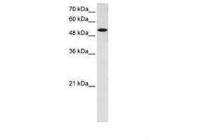 Image no. 1 for anti-Solute Carrier Family 25 (Mitochondrial Carrier, Phosphate Carrier), Member 25 (SLC25A25) (AA 71-120) antibody (ABIN6736655) (SLC25A25 抗体  (AA 71-120))