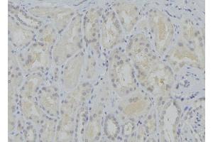 ABIN6273751 at 1/100 staining Mouse kidney tissue by IHC-P. (CYP17A1 抗体  (Internal Region))