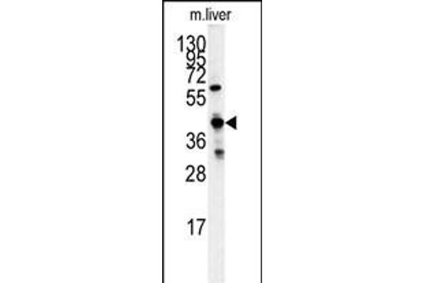 GCAT anticorps  (AA 155-181)