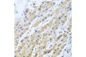 Immunohistochemistry of paraffin-embedded human liver using STC1 antibody at dilution of 1:100 (40x lens). (Stanniocalcin 1 抗体)