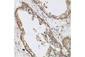 Immunohistochemistry of paraffin-embedded human prostate using CAST antibody (ABIN5970004) at dilution of 1/100 (40x lens). (Calpastatin 抗体)