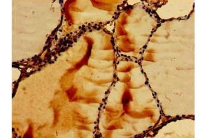 Immunohistochemistry of paraffin-embedded human thyroid tissue using ABIN7167354 at dilution of 1:100 (RAB5 抗体  (AA 1-215))