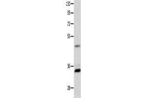 Western Blotting (WB) image for anti-Melanocortin 1 Receptor (MC1R) antibody (ABIN2426175) (MC1 Receptor 抗体)