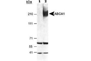 Detection of ABCA1 in mouse peritoneal macrophages using ABCA1 polyclonal antibody . (ABCA1 抗体  (AA 1100-1300))