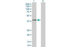 Western Blotting (WB) image for anti-Hydroxy-delta-5-Steroid Dehydrogenase, 3 beta- and Steroid delta-Isomerase 2 (HSD3B2) (AA 1-372) antibody (ABIN516700)