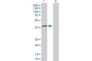Western Blot analysis of HSD3B2 expression in transfected 293T cell line by HSD3B2 MaxPab polyclonal antibody. (HSD3B2 抗体  (AA 1-372))