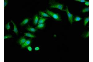 Immunofluorescence staining of Hela cells with ABIN7173964 at 1:133, counter-stained with DAPI. (INPP5B 抗体  (AA 78-178))