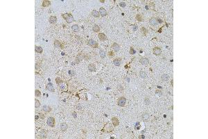 Immunohistochemistry (IHC) image for anti-N-Acetyltransferase 8 (NAT8) antibody (ABIN2737220)