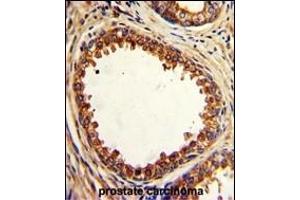 Immunohistochemistry (Paraffin-embedded Sections) (IHC (p)) image for anti-Protein tyrosine Phosphatase Type IVA, Member 2 (PTP4A2) (AA 32-59) antibody (ABIN390820)