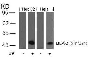 Western blot analysis of extracts from HepG2 and Hela cells untreated or treated with UV using MEK-2(Phospho-Thr394) Antibody. (MEK2 抗体  (pThr394))