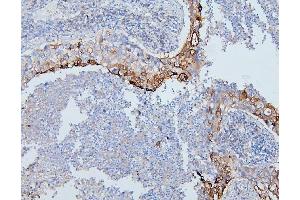 IHC analysis of PYROXD1 using anti-PYROXD1 antibody (ABIN6719650). (PYROXD1 抗体  (AA 48-230))