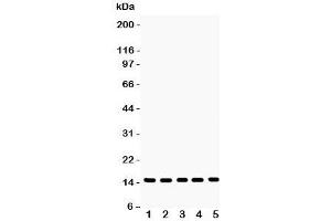 Western blot testing of Profilin-1 antibody and Lane 1:  rat testis;  2: mouse testis;  3: human placenta;  4: (h) PANC;  5: (h) SW620 lysate. (PFN1 抗体  (C-Term))