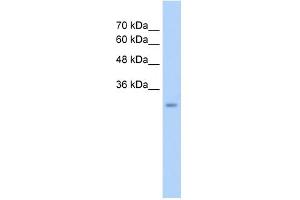 WB Suggested Anti-GEM Antibody Titration:  2.