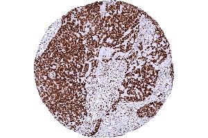 anti-Nuclear Factor I/X (MLZE) (Center) antibody