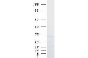 Western Blotting (WB) image for Proteasome (Prosome, Macropain) Inhibitor Subunit 1 (PI31) (PSMF1) (Transcript Variant 1) protein (Myc-DYKDDDDK Tag) (ABIN2730016)
