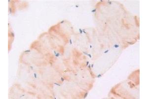 Detection of gp130 in Mouse Skeletal muscle Tissue using Polyclonal Antibody to Glycoprotein 130 (gp130)