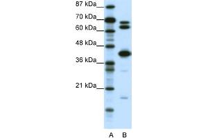 WB Suggested Anti-E2F2 Antibody Titration: 0. (E2F2 抗体  (Middle Region))