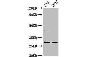 Western Blot Positive WB detected in: 293 whole cell lysate, 293T whole cell lysate All lanes: AANAT antibody at 7. (AANAT 抗体  (AA 1-207))
