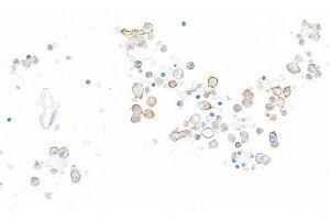 Immunohistochemistry (IHC) image for anti-Hepatitis A Virus Cellular Receptor 2 (TIM 3) (AA 22-201) antibody (ABIN7449550)