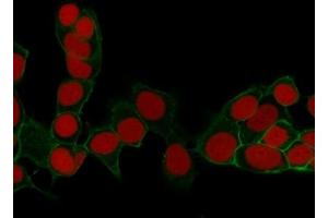 ABIN6383801 to EpCAM was successfully used to stain cellular membranes in cell line MCF7 and in human colorectal carcinoma. (EpCAM 抗体  (Extracellular Domain))