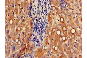 Immunohistochemistry of paraffin-embedded human liver tissue using ABIN7174631 at dilution of 1:100 (UGT1A9 抗体  (AA 277-473))
