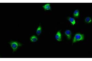 Immunofluorescence (IF) image for anti-Solute Carrier Family 16, Member 11 (Monocarboxylic Acid Transporter 11) (SLC16A11) (AA 428-471) antibody (ABIN7160157)