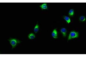 Immunofluorescence staining of A549 cells with ABIN7160157 at 1:150, counter-stained with DAPI. (SLC16A11 抗体  (AA 428-471))