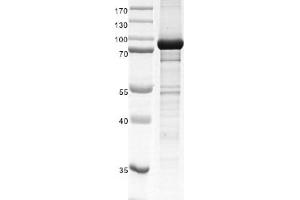 Recombinant SETMAR protein gel.