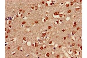 Immunohistochemistry of paraffin-embedded human brain tissue using ABIN7158098 at dilution of 1:100 (SHoc2/Sur8 抗体  (AA 3-89))