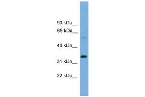 WB Suggested Anti-TM7SF4 Antibody Titration:  0. (Transmembrane 7 Superfamily Member 4 (TM7SF4) (N-Term) 抗体)