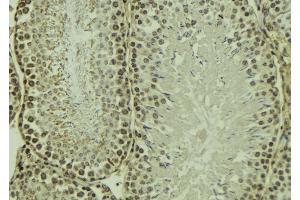 ABIN6269090 at 1/100 staining Mouse testis tissue by IHC-P. (Integrin beta 3 抗体  (C-Term))