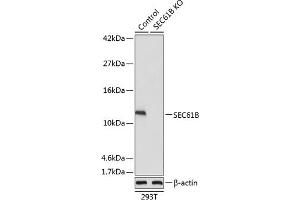 Western blot analysis of extracts from normal (control) and SEC61B knockout (KO) 293T cells, using SEC61B antibody (ABIN7270173) at 1:1000 dilution. (SEC61B 抗体  (AA 1-96))