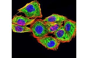 Immunofluorescence (IF) image for anti-Calponin 3, Acidic (CNN3) (AA 26-130) antibody (ABIN7193498)