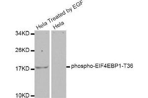 Western blot analysis of extracts of various cell lines, using EIF4EBP1 antibody. (eIF4EBP1 抗体  (pThr37, pThr46))