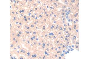 IHC-P analysis of liver tissue, with DAB staining. (ACAA1 抗体  (AA 182-424))