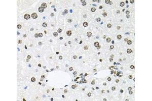 Immunohistochemistry of paraffin-embedded Mouse liver using HDAC3 Polyclonal Antibody at dilution of 1:100 (40x lens). (HDAC3 抗体)