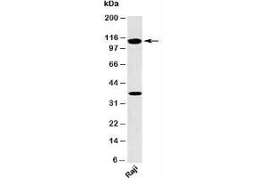 Western blot testing of human samples with TLR9 antibody at 2ug/ml. (TLR9 抗体  (N-Term))