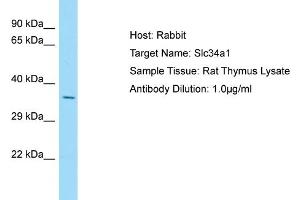 Western Blotting (WB) image for anti-Solute Carrier Family 34 (Type II Sodium/phosphate Contransporter), Member 1 (SLC34A1) (N-Term) antibody (ABIN2781587)