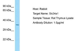 Host: Rabbit Target Name: Slc34a1 Sample Type: Rat Thymus lysates Antibody Dilution: 1. (Solute Carrier Family 34 (Type II Sodium/phosphate Contransporter), Member 1 (SLC34A1) (N-Term) 抗体)