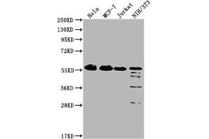 Western Blot Positive WB detected in: Hela whole cell lysate, MCF-7 whole cell lysate, Jurkat whole cell lysate, NIH/3T3 whole cell lysate All lanes: PKM antibody at 1:1000 Secondary Goat polyclonal to Mouse IgG at 1/10000 dilution Predicted band size: 58 kDa Observed band size: 58 KDa Exposure time: 1 min (PKM 抗体  (AA 2-531))