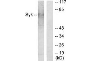 Western blot analysis of extracts from HepG2 cells, using SYK Antibody. (SYK 抗体  (AA 141-190))