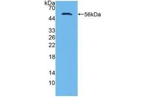 Detection of Recombinant AASS, Human using Polyclonal Antibody to Aminoadipate Semialdehyde Synthase (AASS) (AASS 抗体  (AA 33-455))