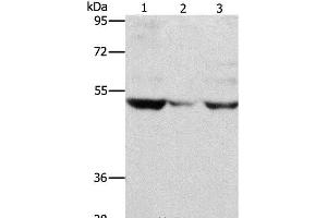 Western Blot analysis of PC3 cell and Mouse muscle tissue, A375 cell using MMP1 Polyclonal Antibody at dilution of 1:500 (MMP1 抗体)