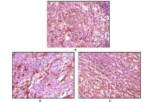 Immunohistochemical analysis of paraffin-embedded human lymph tissue (A), glioma tissue (B) and cerebellum tissue (C), showing membrane localization using Dynamin1 mouse mAb with DAB staining (Dynamin 1 抗体)