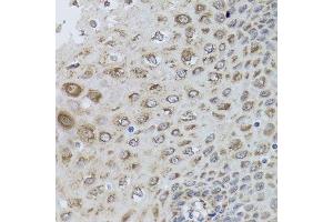 Immunohistochemistry (Paraffin-embedded Sections) (IHC (p)) image for anti-Protein Kinase, AMP-Activated, beta 1 Non-Catalytic Subunit (PRKAB1) (AA 1-80) antibody (ABIN6146174)