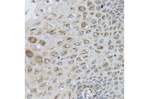 Immunohistochemistry of paraffin-embedded human esophagus using PRKAB1 antibody. (PRKAB1 抗体  (AA 1-80))