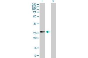 Western Blot analysis of CCRK expression in transfected 293T cell line by CCRK MaxPab polyclonal antibody. (CCRK 抗体  (AA 1-275))