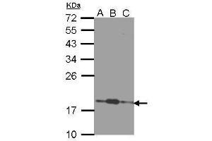 WB Image Sample (30 ug of whole cell lysate) A: 293T B: A431 , C: H1299 12% SDS PAGE antibody diluted at 1:1000 (COMMD7 抗体)