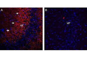 Expression of Synaptophysin in rat hippocampus. (Synaptophysin 抗体  (Intravesicular Loop))